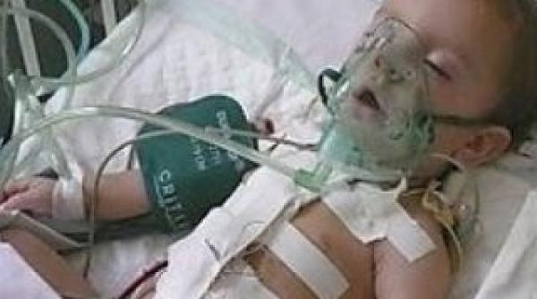 fotografie tulburatoare pe facebook 55 000 de like uri pentru un copil bolnav