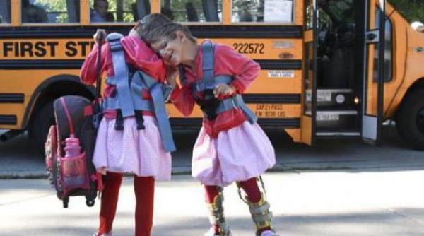 daily mail doua siameze romance asteapta un miracol