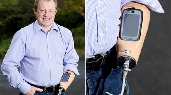 omul cu telefon mobil in proteza care ii tine loc de mana