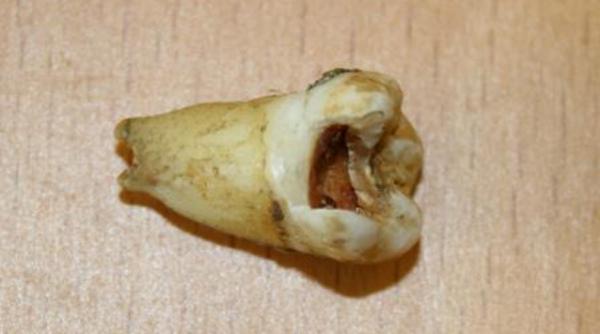 un dinte cariat al lui john lennon vandut la licitatie vezi cu ce suma impresionanta a fost cumparat