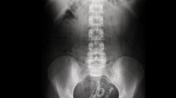 ce si mai introduc oamenii in corp de la casete audio la ipod sau papusi barbie cartea cu 100 de cazuri care au socat pana si psihiatrii