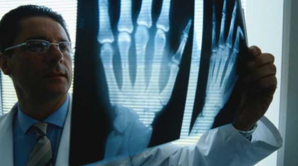 avertisment osteoporoza nu doare dar te aboneaza la ortopedie