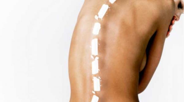 avertisment scolioza una dintre cele mai frecvente boli ale copiilor si adolescentilor