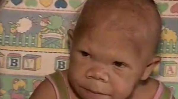 caz medical incredibil are 30 de ani dar seamana cu un bebelus video