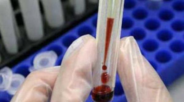 romania pe primul loc in europa la imbolnavirile cu hepatita a