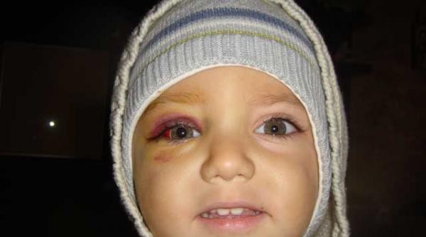 anunt umanitar un baietel de 3 ani are nevoie de ajutorul vostru