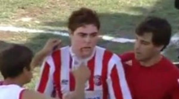 se intampla in argentina portarul unei echipe de amatori a fost eliminat dupa ce si a muscat un adversar video