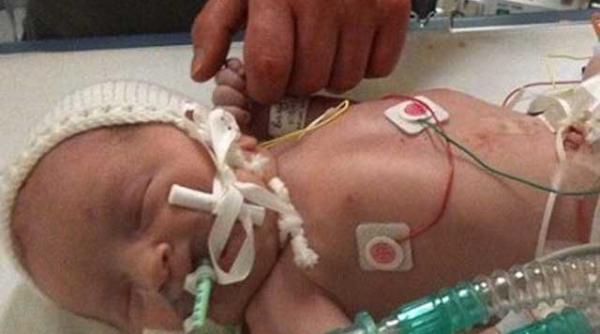 a venit pe lume fara sange si totusi acum este un copil sanatos care invata sa mearga