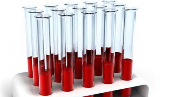 hemoleucograma sanatatea studiata la microscop