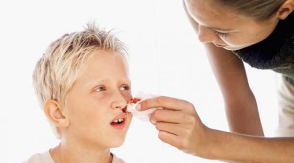 hemoragiile nazale mai frecvente iarna