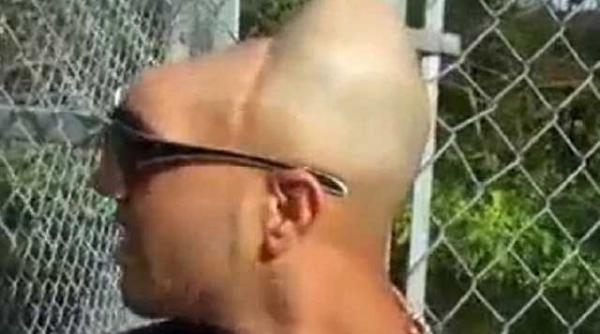 povestea omului cu jumatate de cap video