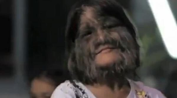 video cum traieste si cum este tratata de comunitate cea mai paroasa fata din lume