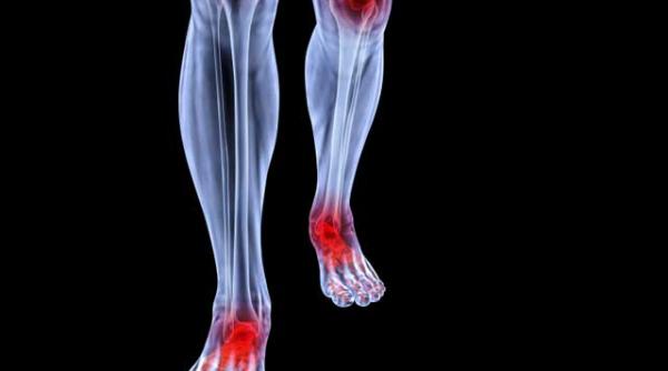 bastonul descarca articulatia