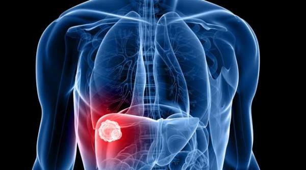 ce este proteina c reactiva