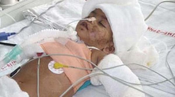 soc in india un copil a fost spitalizat cu urme de muscaturi de om