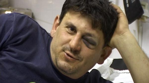 cinci jandarmi au rupt piciorul unui barbat pentru ca sotia conducea prudent