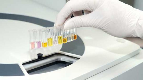 hematurie sau poate nu