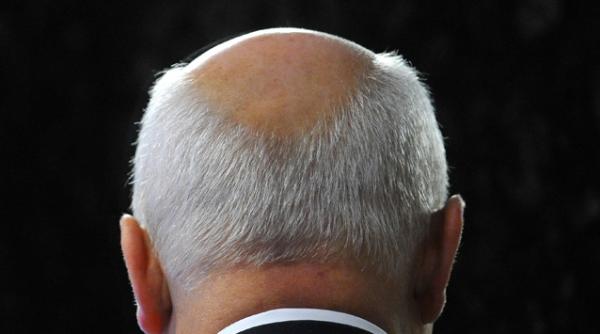 video adio chelie japonezii au descoperit o modalitate de a regenera parul