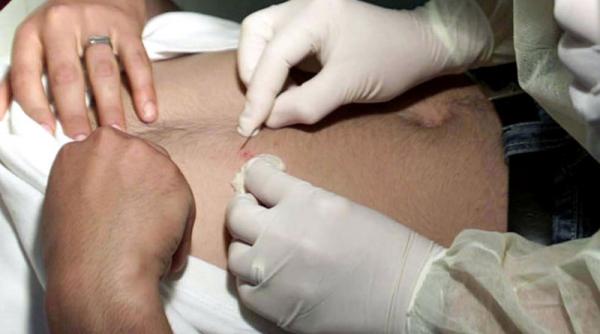 zece persoane intre care cinci copii au ajuns la upu salaj in 48 de ore cu intepaturi de capuse