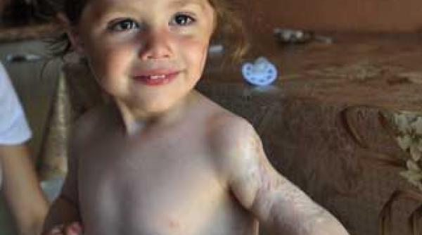 povestea copilului mutilat intr un incubator de spital