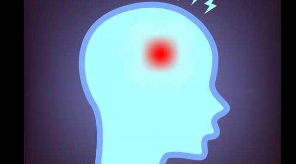 testul atacului cerebral