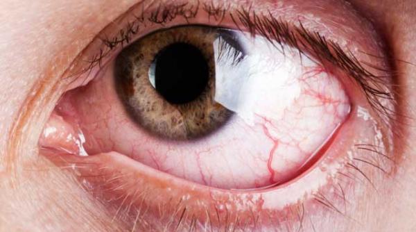 ce boli se vad in ochi