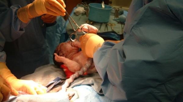 culmea austeritatii un bebelus tinut ostatic intr o maternitate din atena pana la plata operatiei prin cezariana