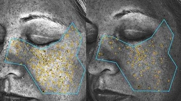 adio riduri o bautura inventata de nasa menita sa i protejeze pe astronauti are efecte miraculoase pentru ten video