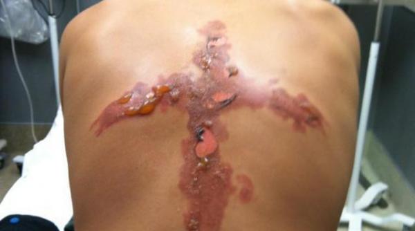 s a mutilat urmand o noua provocare online sare cu gheata jocul care devine moda in randul adolescentilor video