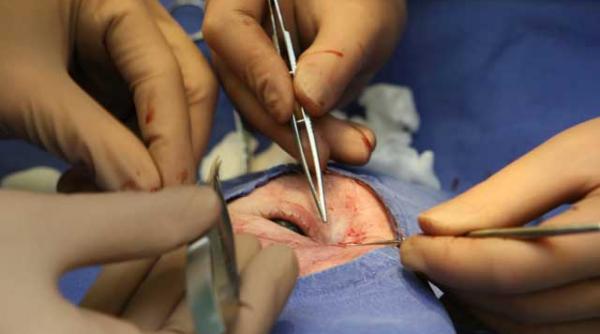 tratamentul in glaucom