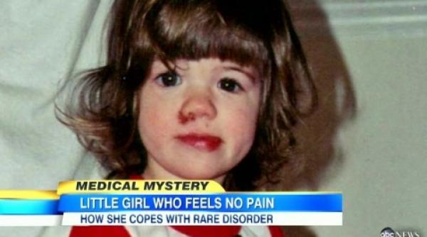 uluitor miracol medical fetita de 12 ani care nu simte durerea video