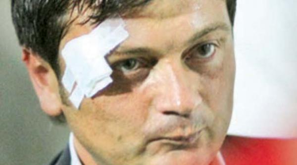 porumboiu daniel stanciu i a bagat degetele in ochi antrenorului secund de la fenerbahce