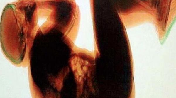 in ce hal arata un barbat de 36 ani culmea cazul nu este singular