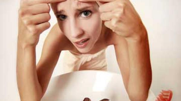 acneea amintirea urata din adolescenta