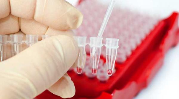 o noua boala asemanatoare cu sida depistata in asia