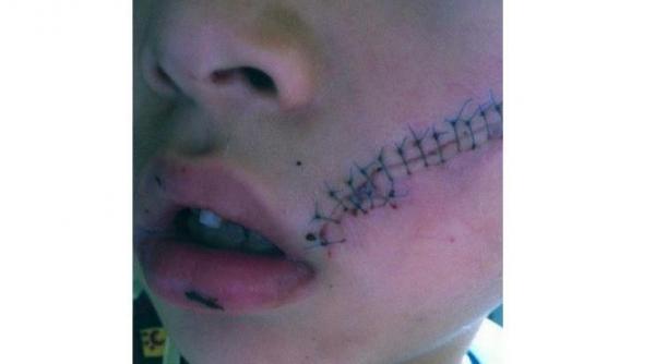 s a ales cu obrazul sectionat dupa ce o doza de suc i a explodat in fata