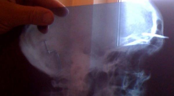 protest insangerat la penitenciarul colibasi vezi ce au facut doi detinuti