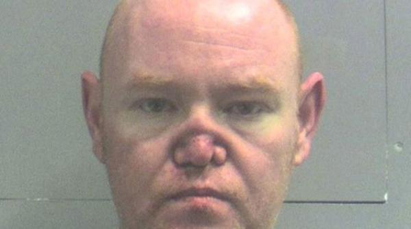 un milionar britanic a consumat atat de multa cocaina incat i s a naruit nasul