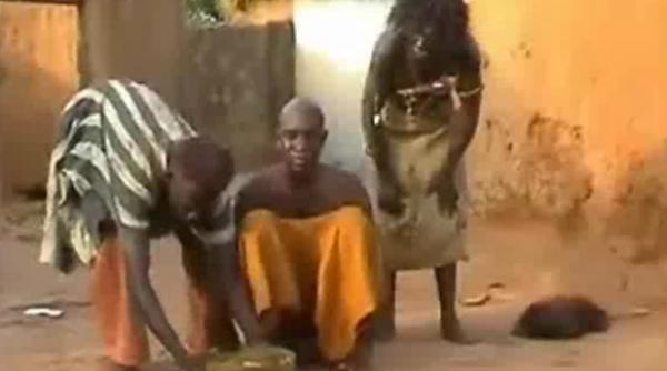 tratament migrena mozambic