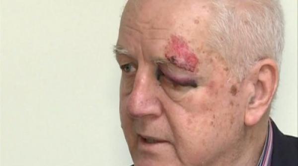 jean padureanu atacat in plina strada daca nu strigam hotii apucam si l biruiam