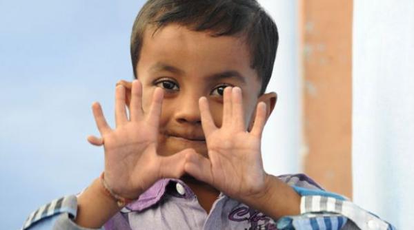 copilul cu 25 de degete traieste in india iar parintii nu doresc sa l opereze pentru a ramane celebru