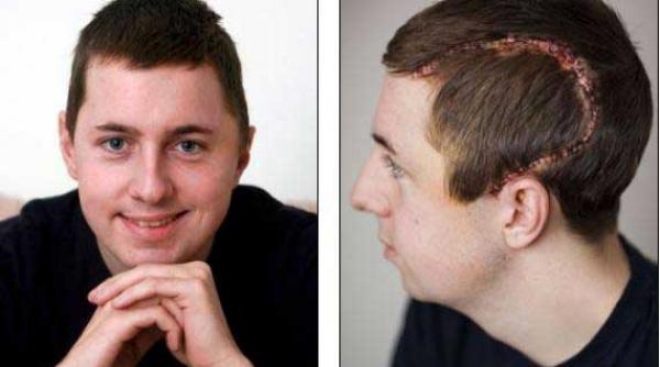 video un camion de 15 tone a trecut peste el insa el a trisat moartea medicii i au adunat corpul dezmebrat intr o patura