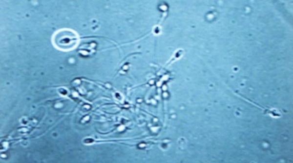 studiu scade calitatea spermei