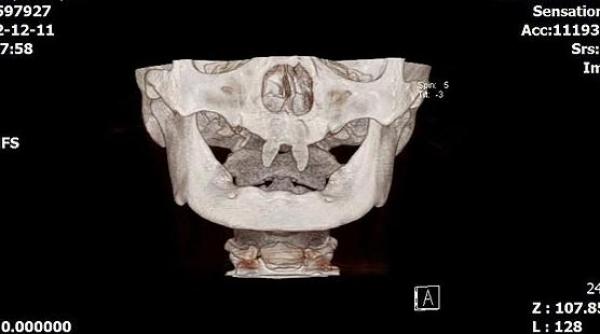 caz bizar in china ce au descoperit medicii in gura unui baiat isi ataca colegii nu are niciun prieten