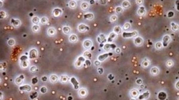 premiera mondiala in stiinta cercetatorii au creat celulele injectabile care omoara cancerul