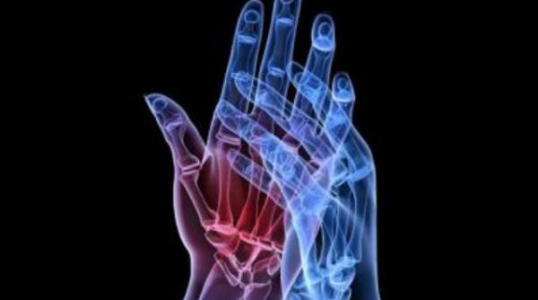 ce risti daca iti trosnesti degetele