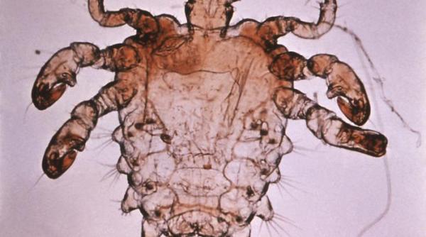 paduchi lati latei epilare