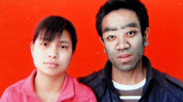 povestea inspirationala a barbatului care a fost poreclit copilul paros