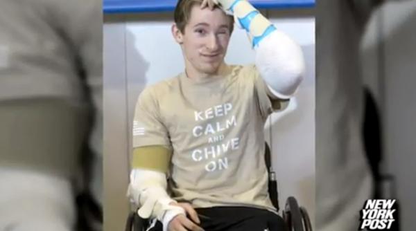 primul dublu transplant de maini incununat de succes