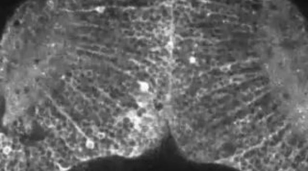 descoperire incredibila ce se intampla in creier atunci cand se formeaza un gand video